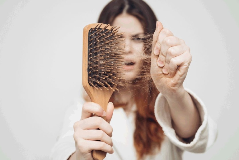 Rụng tóc vì stress: Nguyên nhân và cách khắc phục